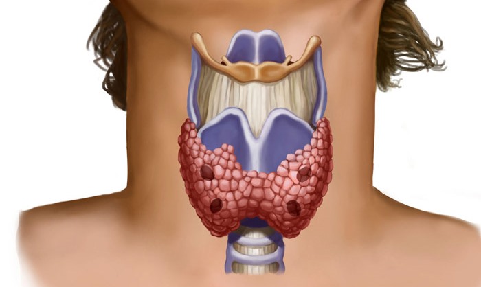 8 вещей в вашем доме, которые наносят вред щитовидной железе