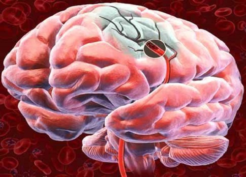 Пять советов для улучшения кровоснабжения головного мозга