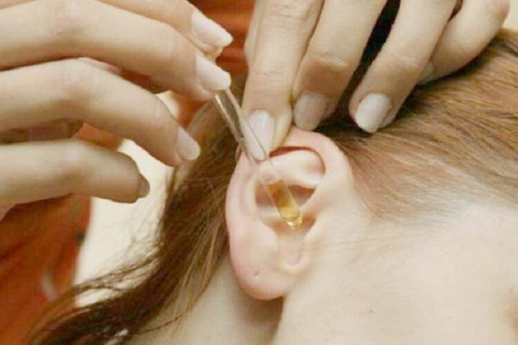 Серные пробки в ушах удалить совсем несложно. Этот рецепт самый безопасный!