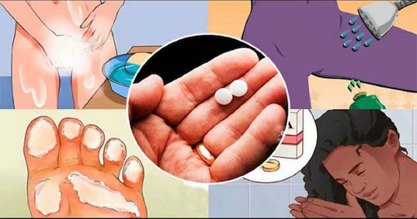 10 трюков с аспирином, которые каждая женщина должна знать. Это изменит вашу жизнь