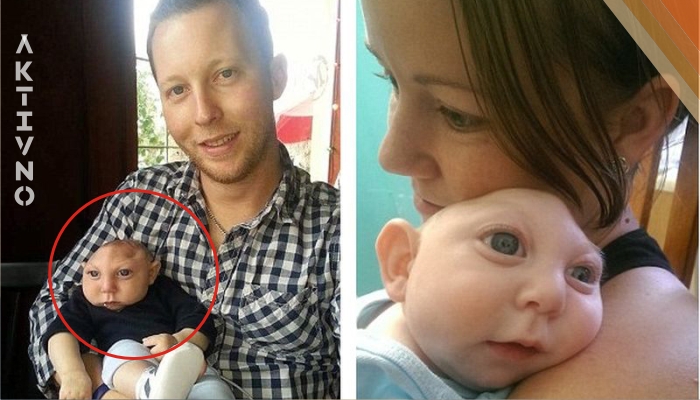 Этот малыш родился без мозга. 3 года спустя врачи не поверили своим глазам, когда увидели снимки