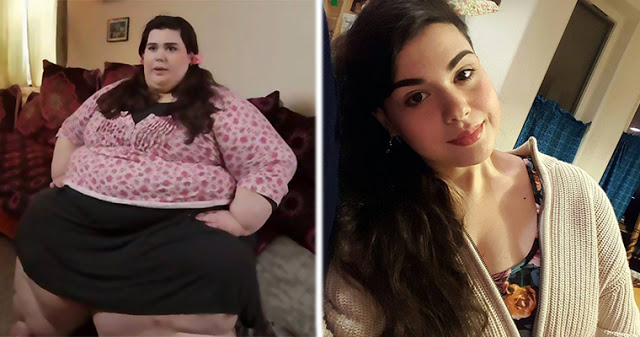 Эта 24-летняя девушка год назад весила 300 кг. Сейчас она изменилась до неузнаваемости...