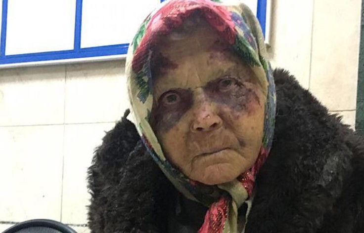 Старушку избили в аэропорту, но милиция и медики отказались ей помогать, считая, что она бомж…До слез!