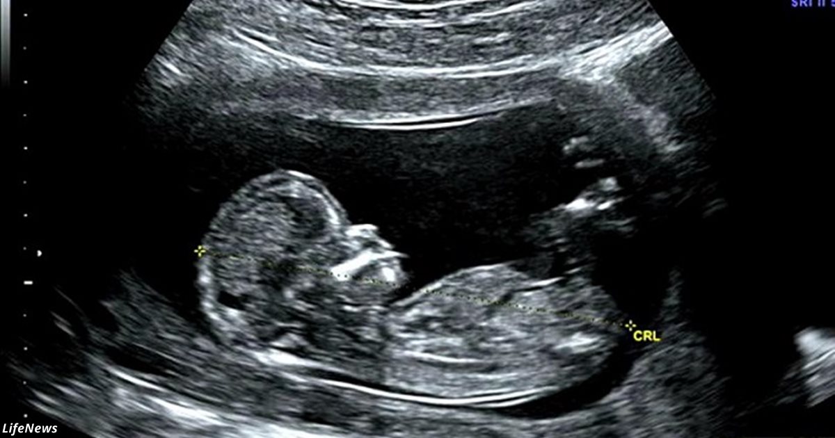 Учёные: нерождённые дети чувствуют боль во время абортов уже в 12 недель