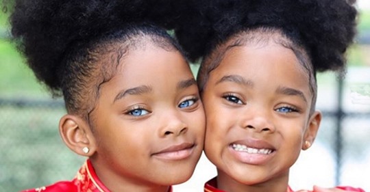 Сестры близняшки покорили мир своей чарующей красотой. Как выглядят дети спустя 4 года