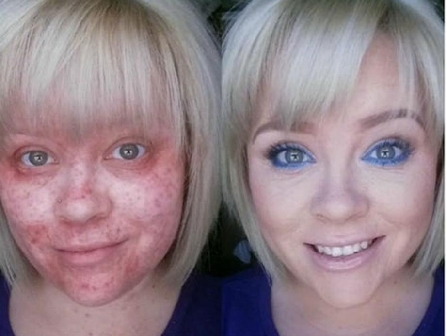 10 случаев, когда макияж действительно сотворил чудо!